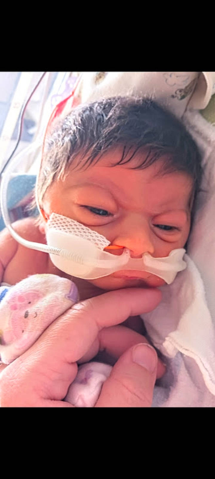 Mylie is registered to the contest to win money with this photo: cheek, chin, ear, eye, eyebrow, eyelash, facial_expression, forehead, gesture, hand, happy, human, jaw, lip, mouth, neck, nose, organ, person, skin