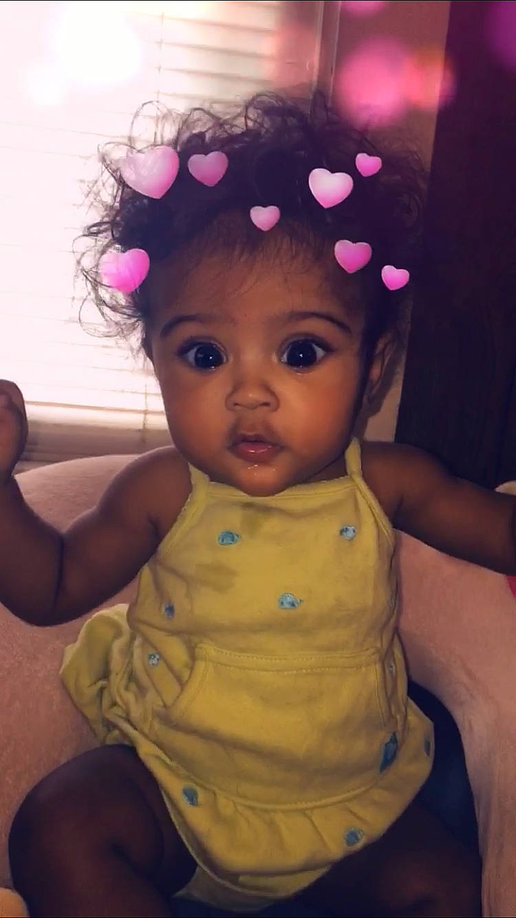 Rosalina White joined the competition — help win amazing prizes! baby, cheek, child, ear, eye, face, forehead, hair_accessory, head, headband, headgear, person, pink, toddler