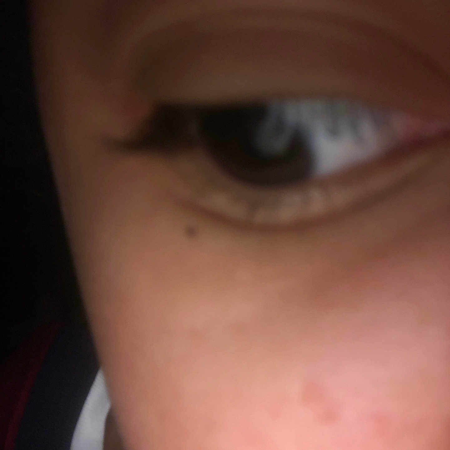 Chicken joined the competition — help win amazing prizes! accessories, baby, bodypart, contactlens, cosmetics, face, finger, freckle, frown, glasses, hand, head, mouth, person, photography, piercing, portrait, sad, selfie, skin