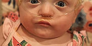 Emery Rose is registered to the contest to win money with this photo: baby, infant, face, blue_eyes, nasal_cannula, medical_tube, pink_clothing, watermelon_pattern, closeup, portrait, child, floral_background, cute, skin, head, person, young, expressionless, indoors, newborn