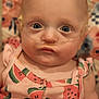 baby, infant, face, blue_eyes, nasal_cannula, medical_tube, pink_clothing, watermelon_pattern, closeup, portrait, child, floral_background, cute, skin, head, person, young, expressionless, indoors, newborn
