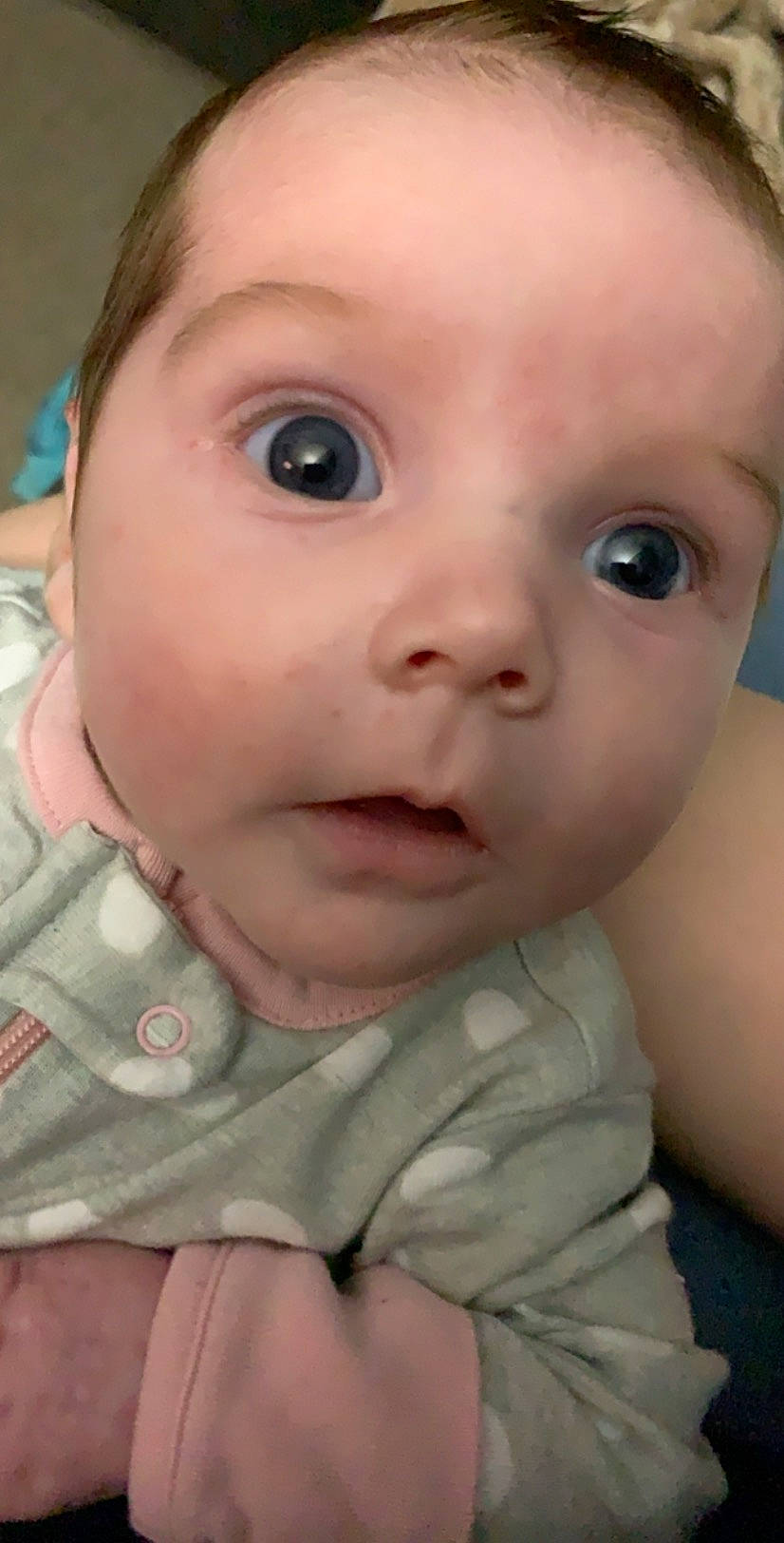 Kenzlee is registered to the contest to win money with this photo: baby, baby_making_funny_faces, cheek, child, chin, close_up, eye, eyebrow, eyelash, face, facial_expression, forehead, head, iris, lip, mouth, neck, nose, person, skin