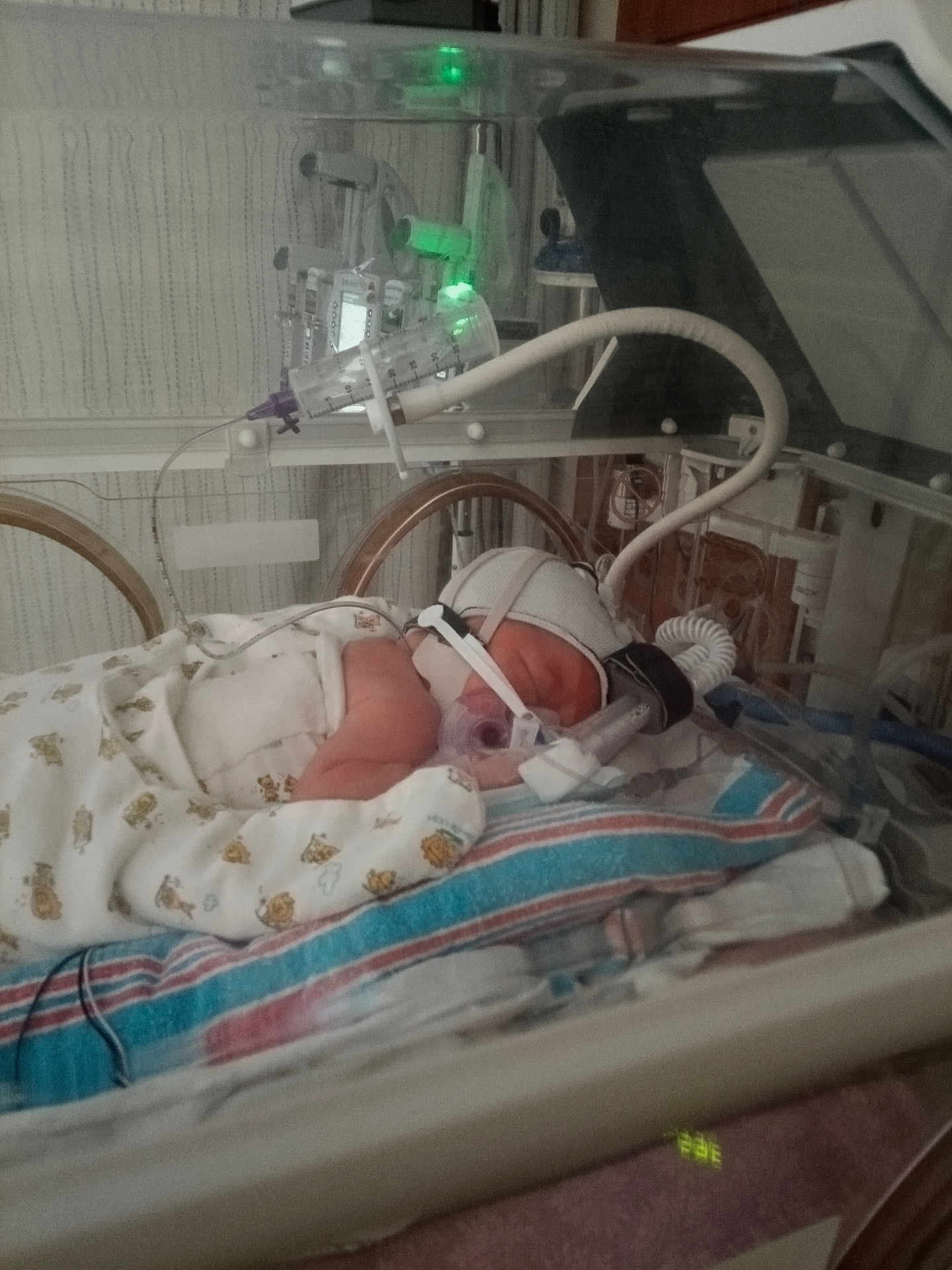 Lyrah joined the competition — help win amazing prizes! baby, newborn, incubator, hospital, medical_device, ventilator, tubing, blanket, swaddle, hat, monitoring, iv_drip, nicu, crib, healthcare, sleeping, face_mask, medical_equipment, pillow, hospital_bed