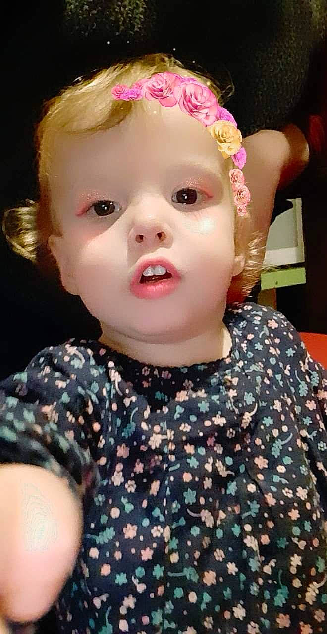 Noéline a rejoint le concours — aidez-le/la à gagner de superbes lots ! baby, cheek, child, child_model, ear, eye, eyelash, face, forehead, hair, hair_accessory, head, iris, lip, nose, person, toddler