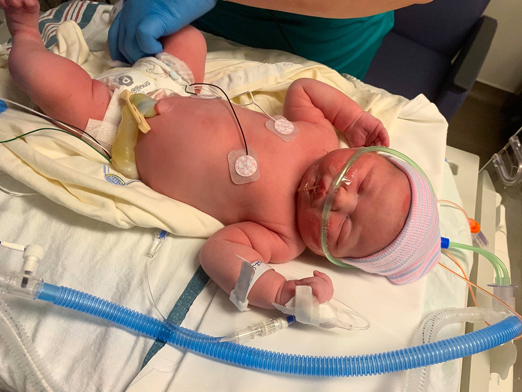 Paislynn joined the competition — help win amazing prizes! arm, baby, chest, child, finger, hand, headwear, health_care, health_care_provider, hospital, joint, medical, medical_equipment, medical_procedure, mouth, patient, pediatrics, person, service, skin