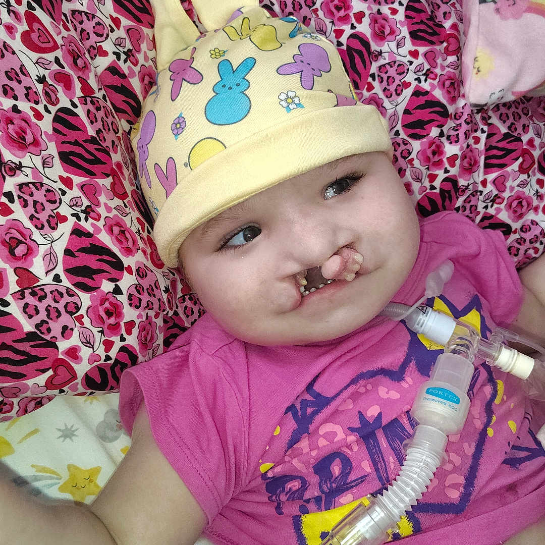Gracie is registered to the contest to win money with this photo: baby, infant, hat, pink_shirt, breathing_tube, medical_equipment, blanket, patterned_blanket, cute, lying_down, bed, child, face, smile, colorful, soft_toys, indoor, closeup, healthcare, hospital