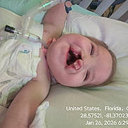 Gracie joined the competition — help win amazing prizes! baby, infant, smiling, cleft_lip, medical_tube, hospital_bed, white_blanket, happy, child, lying_down, healthcare, medical_equipment, face, person, indoors, closeup, newborn, cute, patient, resting