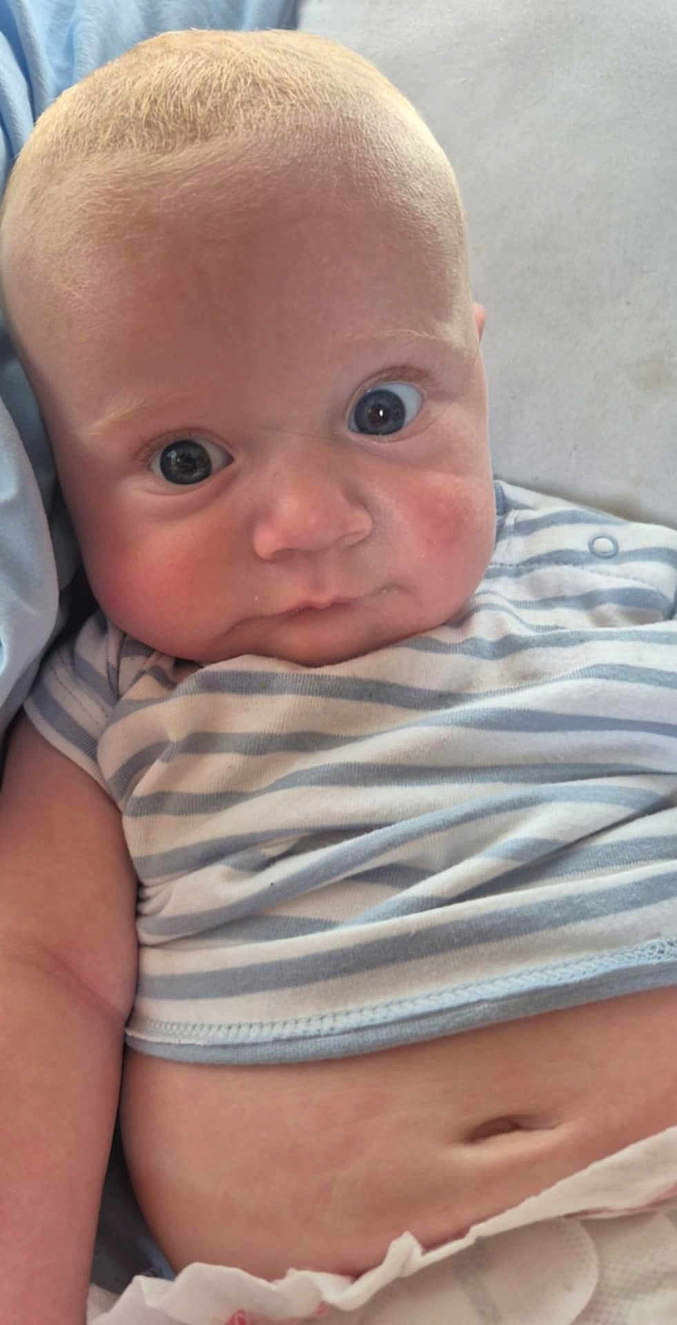 Ace joined the competition — help win amazing prizes! baby, infant, face, wide_eyes, striped_shirt, skin, arm, belly, close_up, curious, lying_down, natural_light, child, human, cute, expression, indoor, soft_texture, young, portrait