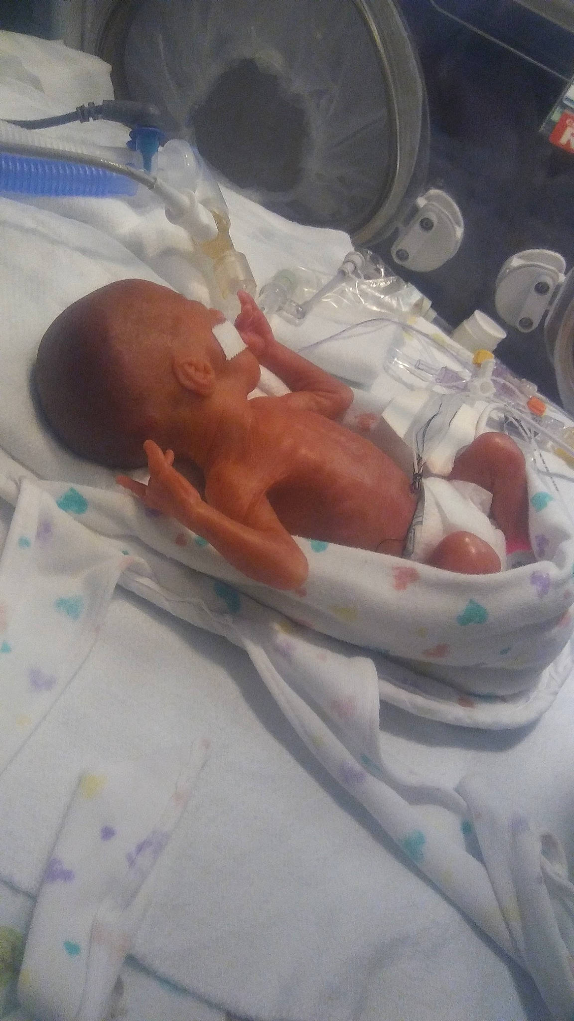 Isaiah is registered to the contest to win money with this photo: baby, baby_products, baby_safety, bedtime, child, childbirth, comfort, event, health_care, hospital, hospital_bed, linens, mouth, patient, pediatrics, person, room, service, skin, sleep