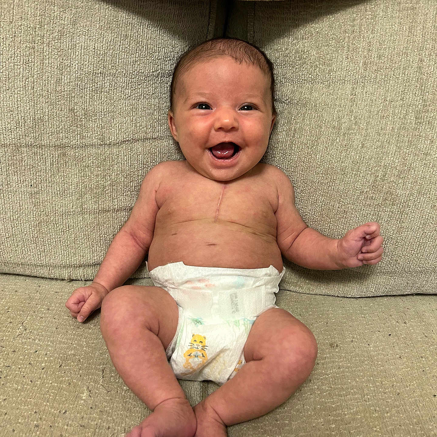 Adeline joined the competition — help win amazing prizes! baby, infant, smiling, diaper, sitting, couch, scar, skin, happy, child, human, face, arms, legs, furniture, indoors, cute, young, expression, health