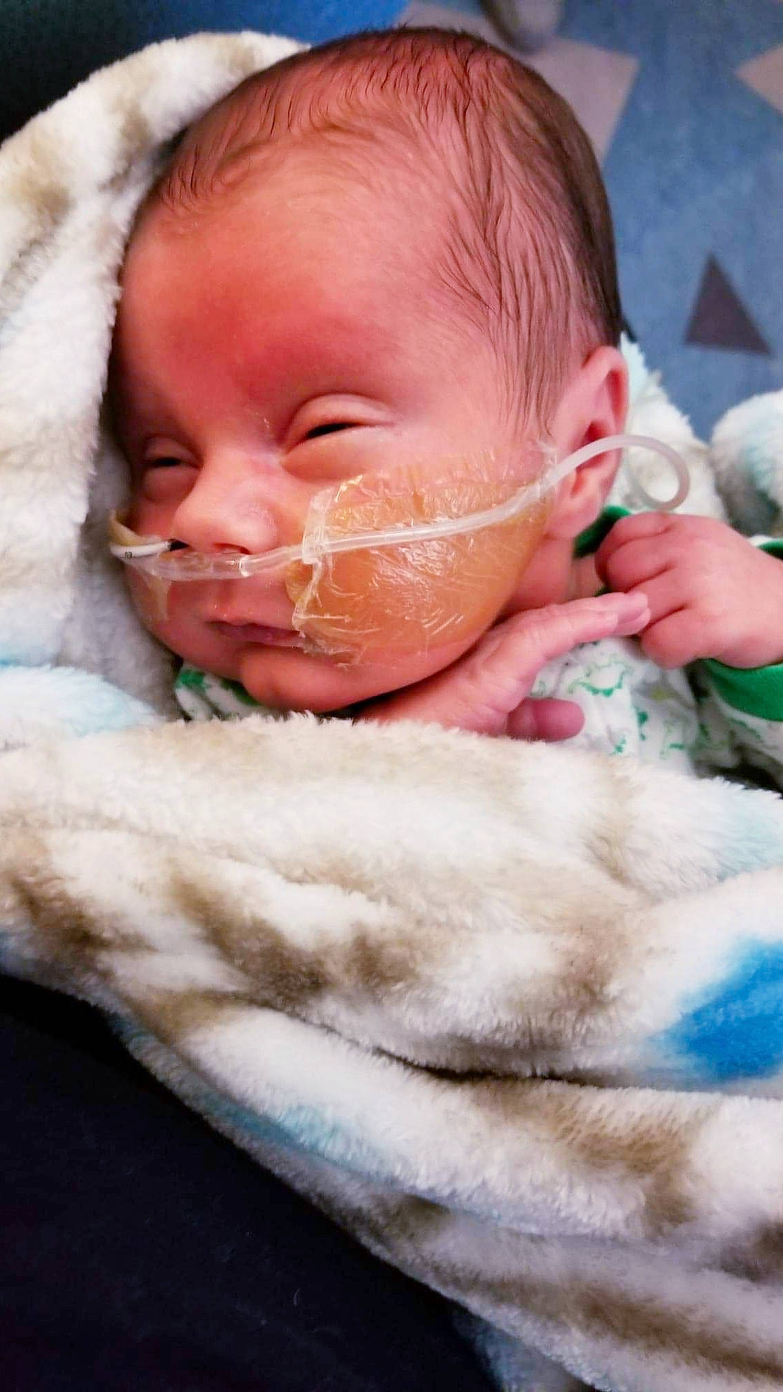 Jesco joined the competition — help win amazing prizes! cheek, child, ear, eye, face, fur, girl, head, infant, lip, material, nap, nose, person, product, skin, sleep, snout, textile, toddler