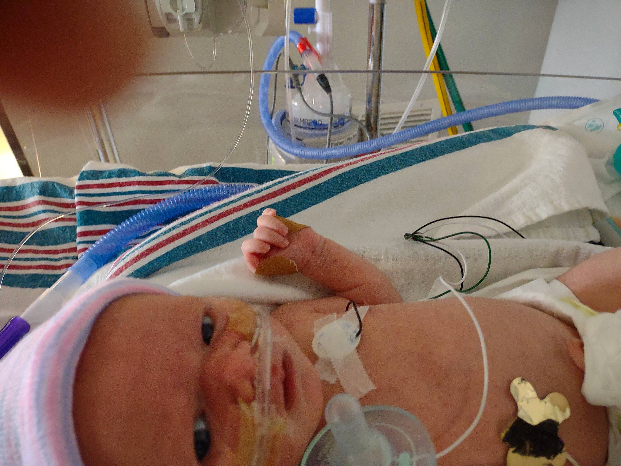 Helen is registered to the contest to win money with this photo: abdomen, baby, chest, child, comfort, engineering, event, foot, health_care, hospital, hospital_bed, medical, medical_equipment, medical_procedure, patient, person, room, science, service, thumb