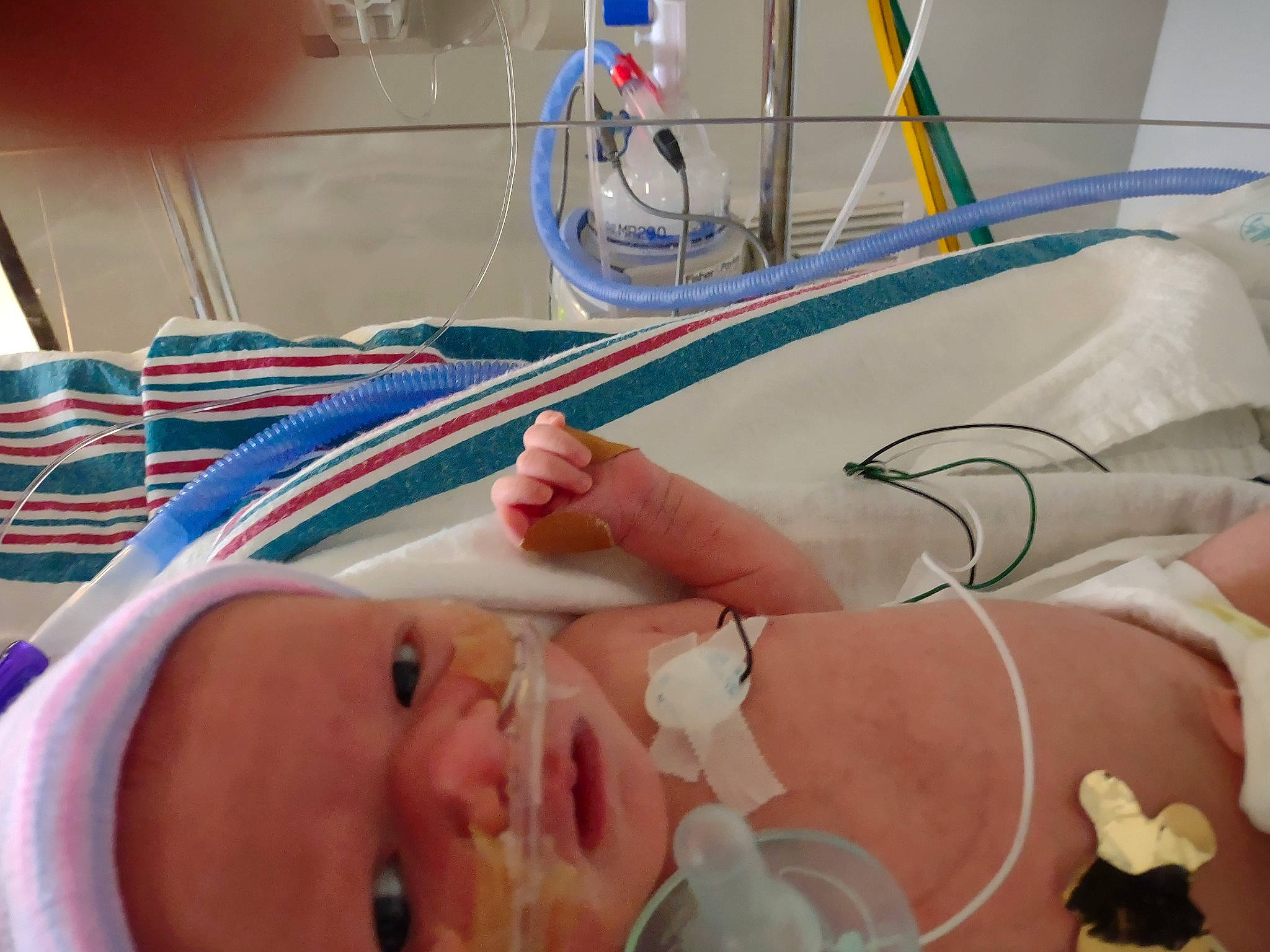 Helen joined the competition — help win amazing prizes! baby, chest, child, comfort, engineering, event, eyelash, finger, health_care, hospital, hospital_bed, medical, medical_equipment, medical_procedure, patient, person, science, service, skin, thumb