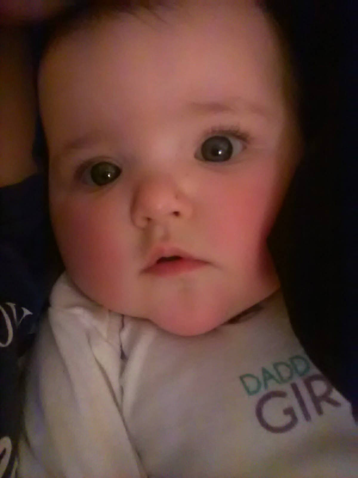 Aubrey Ella is registered to the contest to win money with this photo: cheek, child, chin, close_up, ear, eye, eyebrow, face, finger, forehead, girl, head, infant, iris, lip, mouth, nose, person, skin, toddler