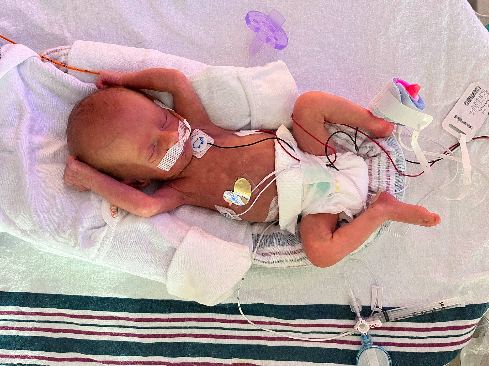 Eli joined the competition — help win amazing prizes! abdomen, art, baby, baby_products, bedding, child, comfort, diaper, dress, event, flesh, hat, human_leg, knee, linens, pattern, person, room, thigh, toddler