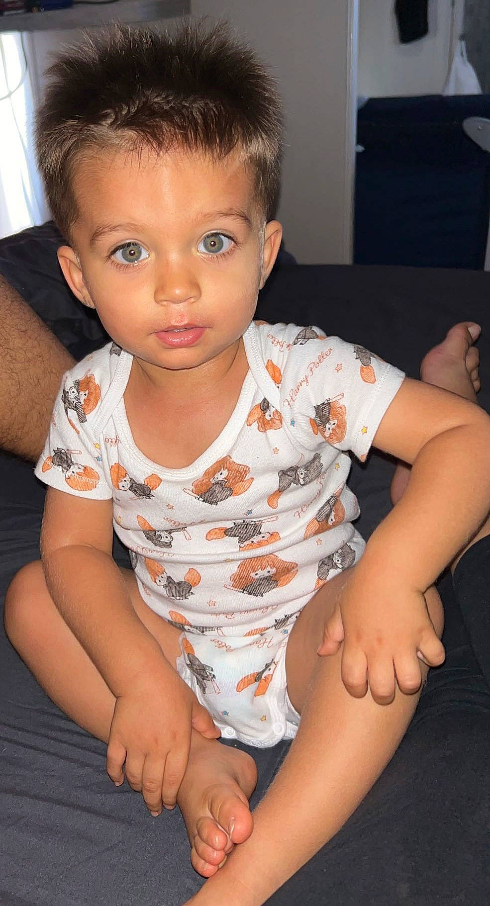 Ilan participe au concours pour gagner de l'argent avec cette photo : arm, cheek, chin, eyebrow, eyelash, finger, forehead, hairstyle, head, human_body, iris, joint, lip, mouth, muscle, neck, nose, person, shoulder, skin