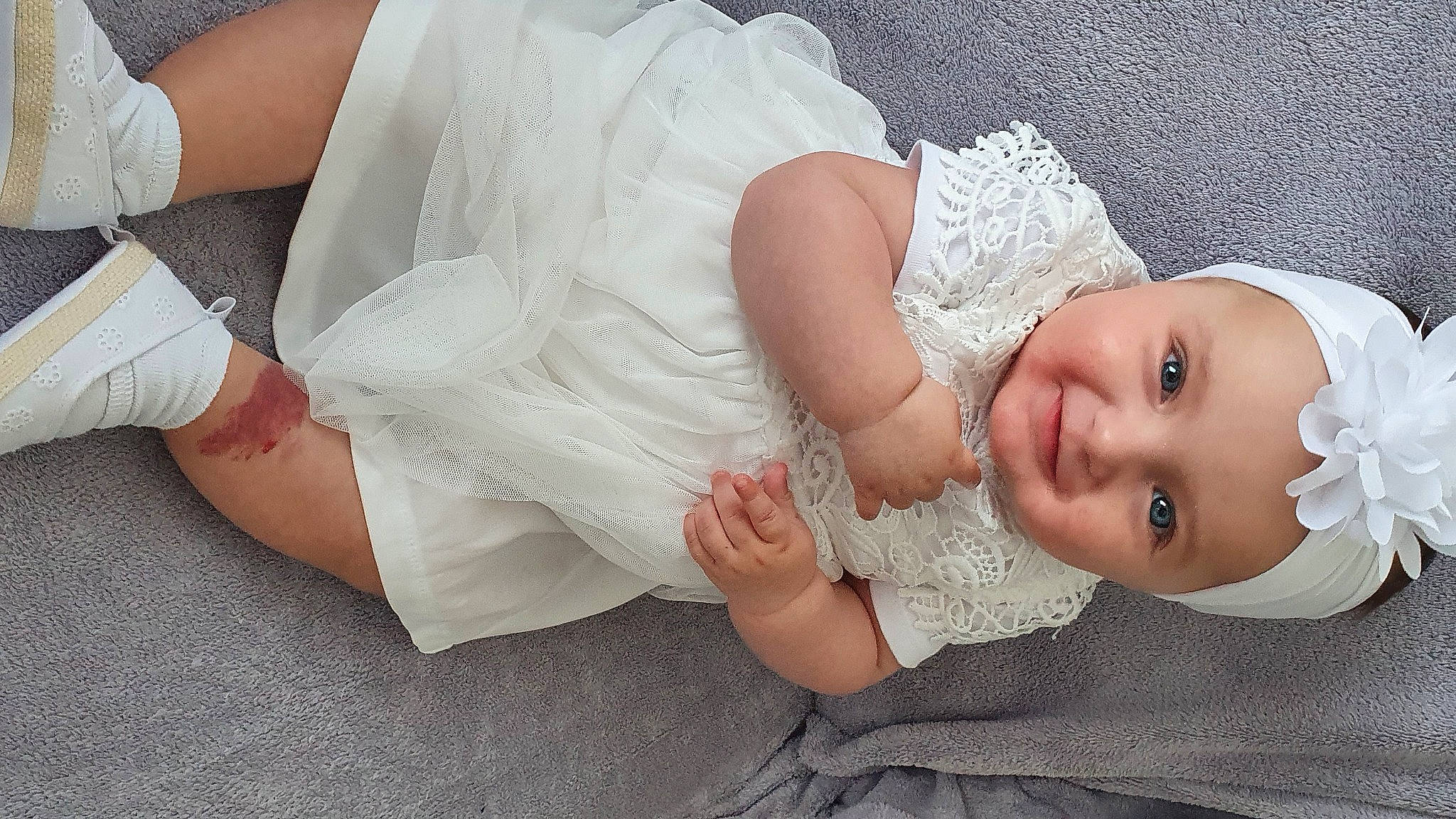 Elise a rejoint le concours — aidez-le/la à gagner de superbes lots ! baby, baby_toddler_clothing, bridal_accessory, child, comfort, dress, eye, finger, gesture, happy, hat, headpiece, headwear, human_body, human_leg, jewellery, joy, person, skin, sleeve