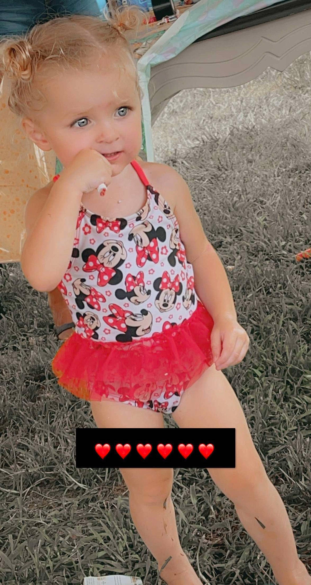 Caleigh joined the competition — help win amazing prizes! arm, baby, baby_toddler_clothing, face, fashion, finger, grass, human_body, joint, knee, leg, neck, organ, person, photograph, pink, shorts, skin, thigh, waist