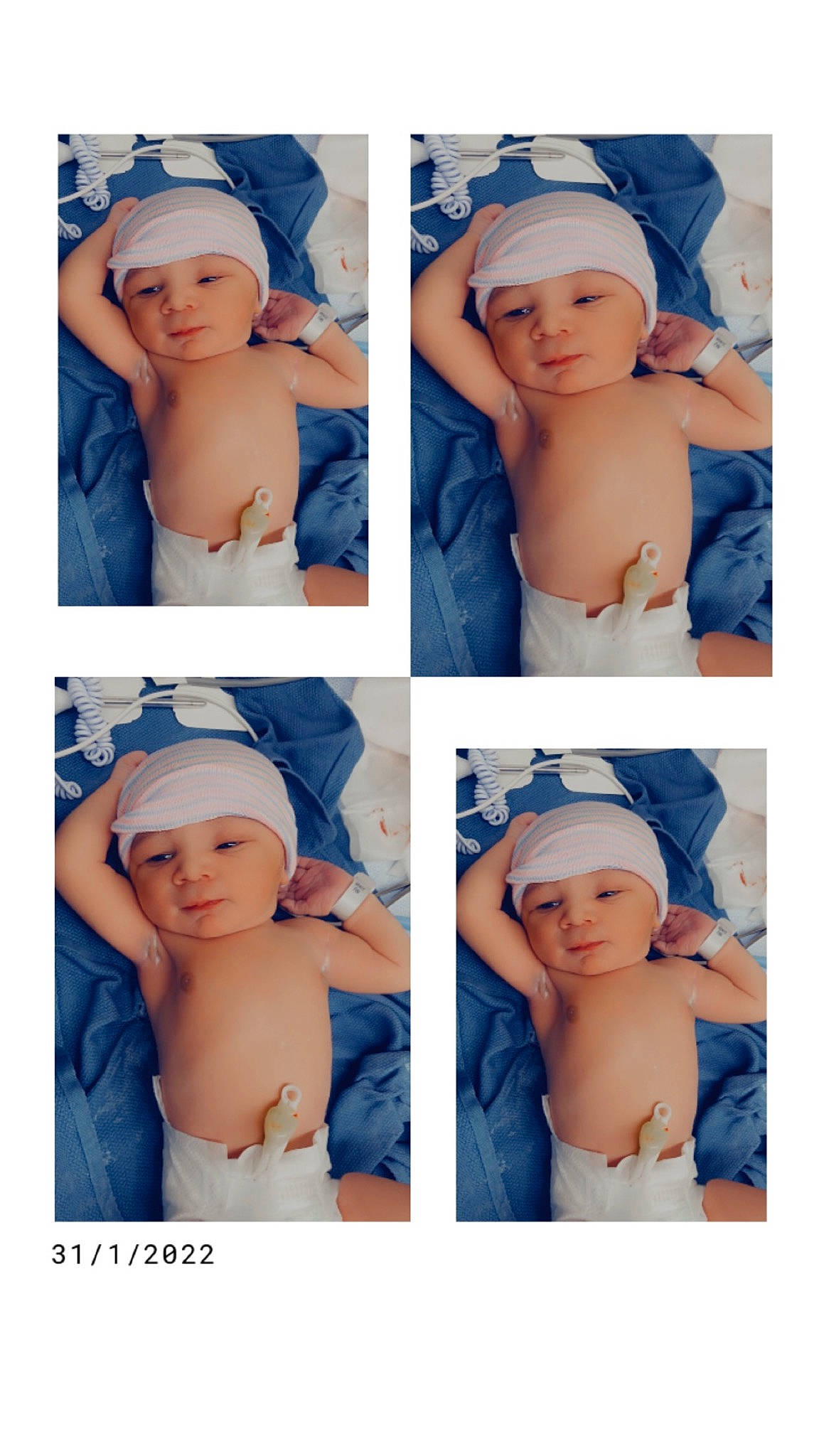 Zahkai joined the competition — help win amazing prizes! arm, azure, baby, blue, cap, chin, eyelash, face, finger, gesture, hand, head, headgear, headwear, human_body, muscle, neck, person, photograph, product