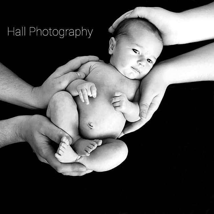 Emberjoy is registered to the contest to win money with this photo: abdomen, baby, black_and_white, chest, comfort, elbow, finger, flash_photography, gesture, hand, happy, human_body, monochrome, monochrome_photography, nail, person, stomach, style, thumb, toddler