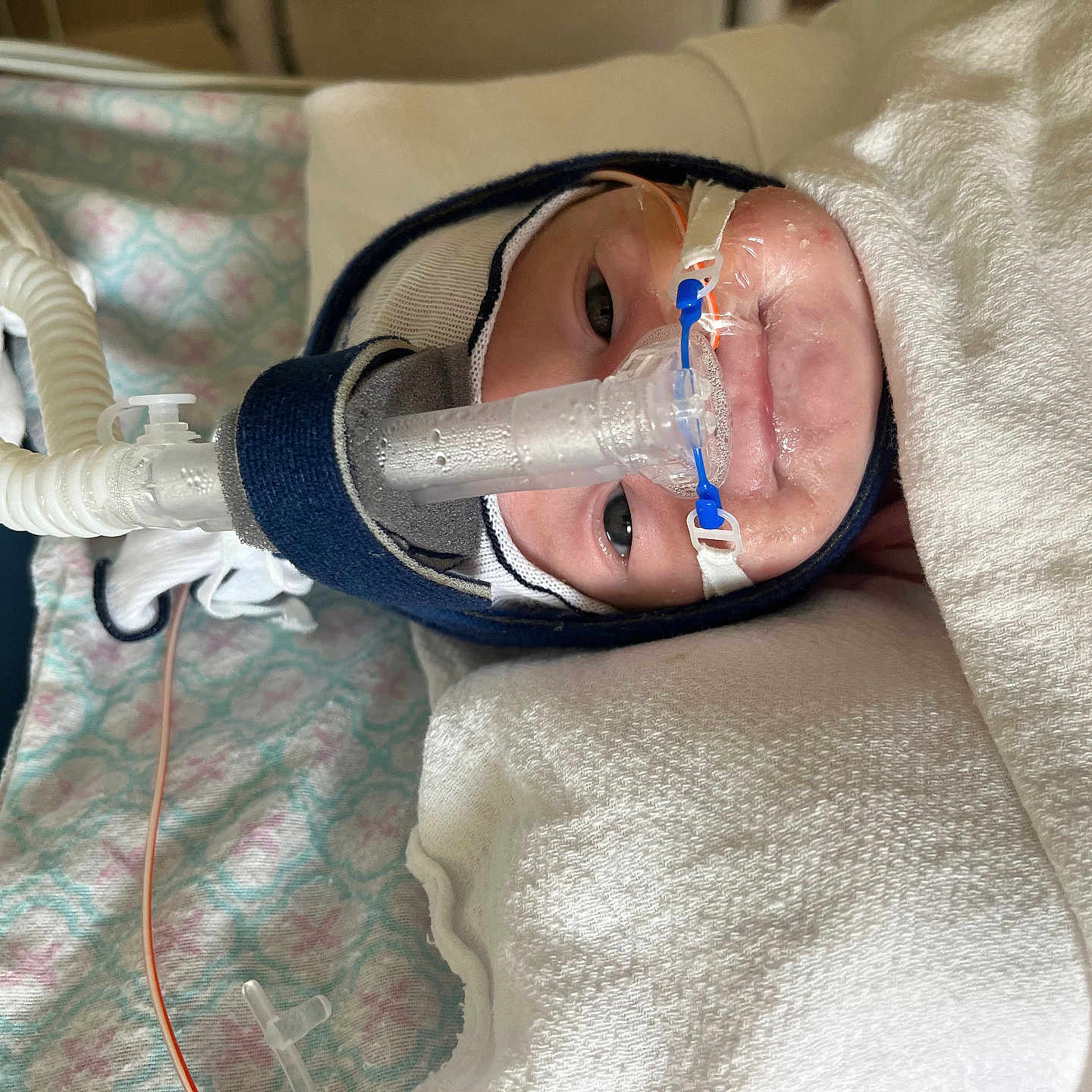 Ysa joined the competition — help win amazing prizes! architecture, baby, bed, blade, bodypart, building, clinic, face, finger, furniture, hand, head, hospital, newborn, operatingtheatre, person, photography, portrait, razor, weapon