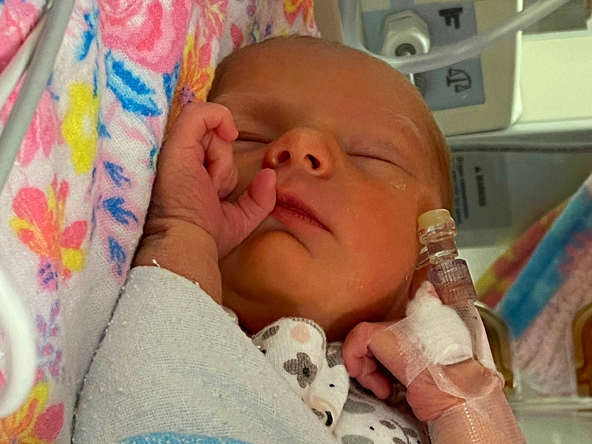 Ivie Reine is registered to the contest to win money with this photo: baby, cheek, child, comfort, ear, eyebrow, eyelash, finger, health_care, linens, medical, medical_equipment, medical_procedure, mouth, neck, nose, patient, person, skin, thumb