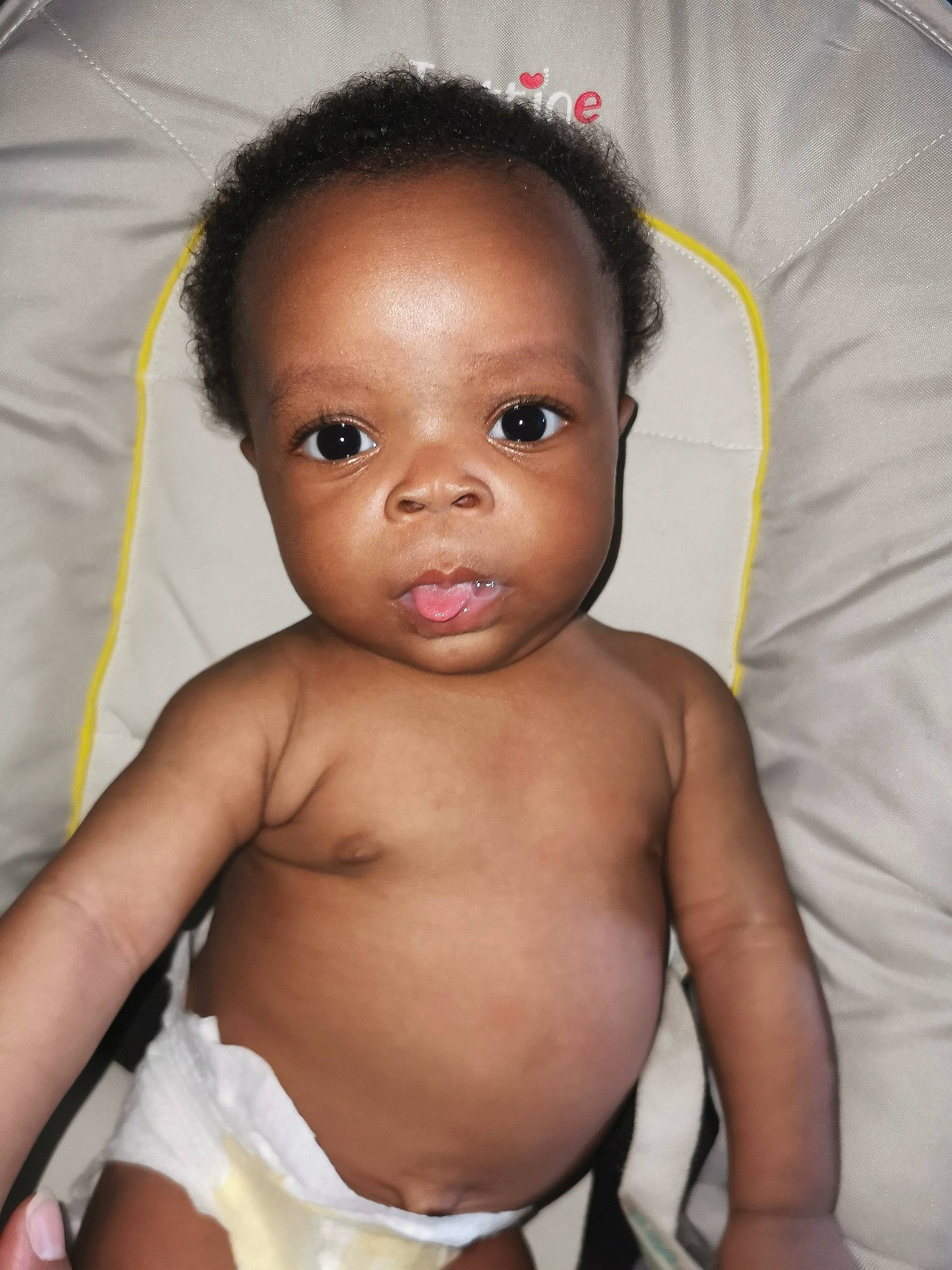 Kaïna participe au concours pour gagner de l'argent avec cette photo : arm, baby, cheek, chin, eye, eyebrow, eyelash, face, flash_photography, hair, head, human_body, iris, lip, mouth, neck, nose, person, skin, stomach