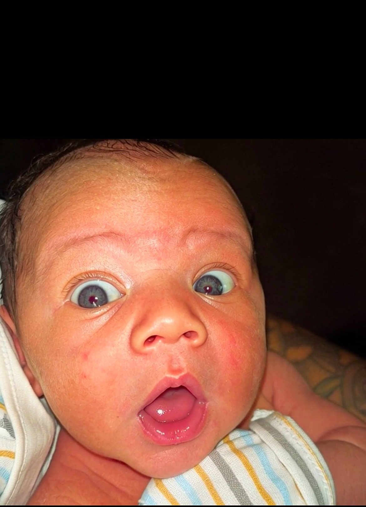 Kross joined the competition — help win amazing prizes! baby, face, wide_eyes, surprised, mouth_open, skin, infant, portrait, close_up, expression, newborn, person, child, human, cute, stripes, cloth, wrapped, head, background