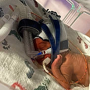 Anylah joined the competition — help win amazing prizes! baby, bed, blanket, closeup, face, fragile, healthcare, hospital, incubator, infant, medical_equipment, monitoring, newborn, patient, person, premature, resting, sleeping, tiny, tubes