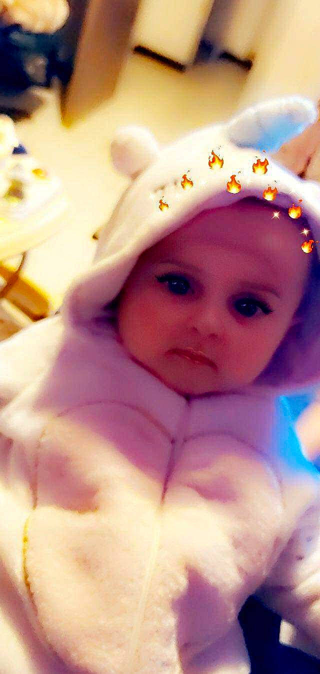 Lisea a rejoint le concours — aidez-le/la à gagner de superbes lots ! baby, cheek, child, eye, person, pink, skin, toddler