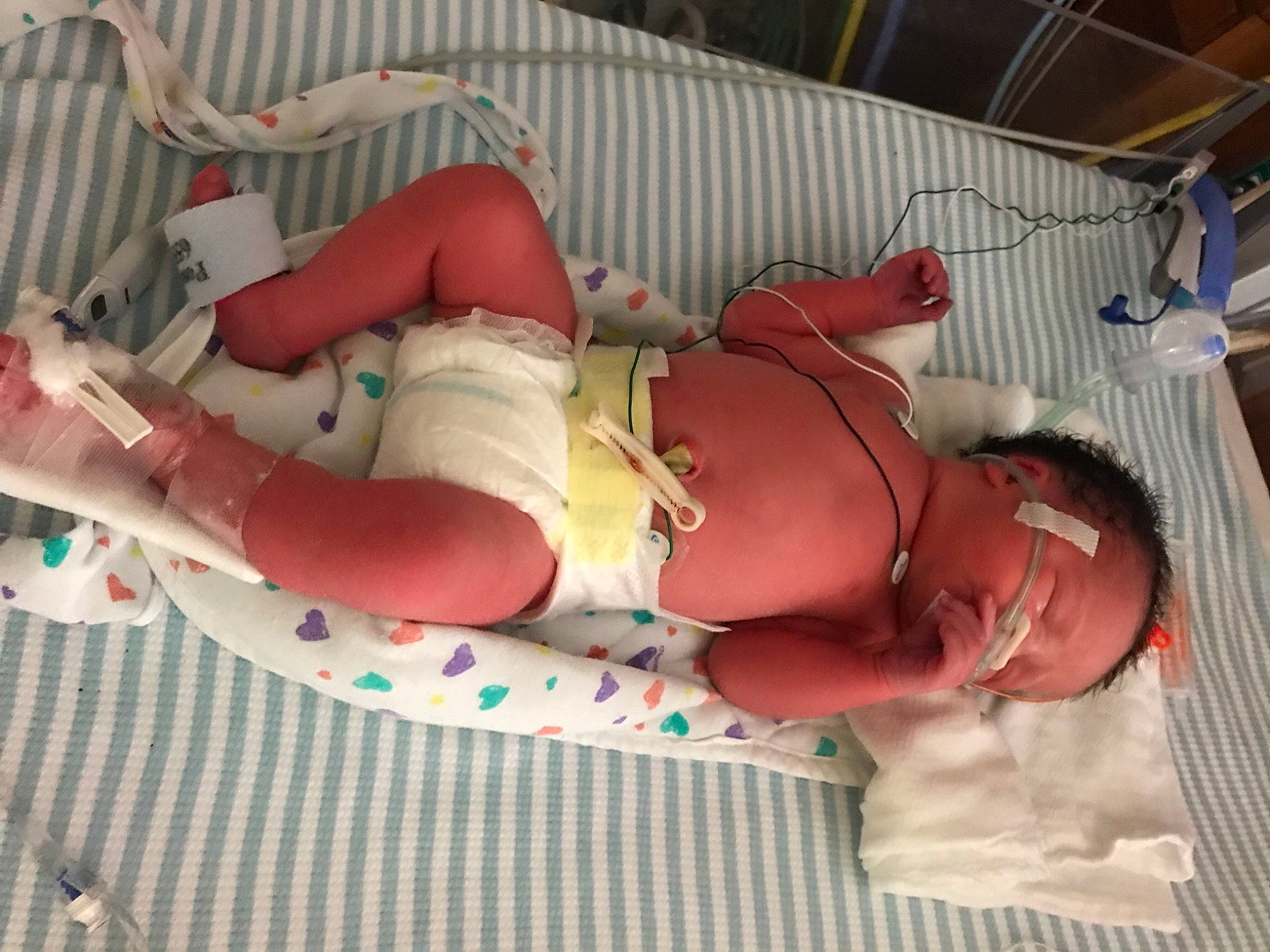 Kadence joined the competition — help win amazing prizes! abdomen, baby, baby_products, baby_toddler_clothing, carmine, chest, child, comfort, elbow, flesh, human_body, human_leg, joint, knee, leg, mouth, person, room, thigh, toddler