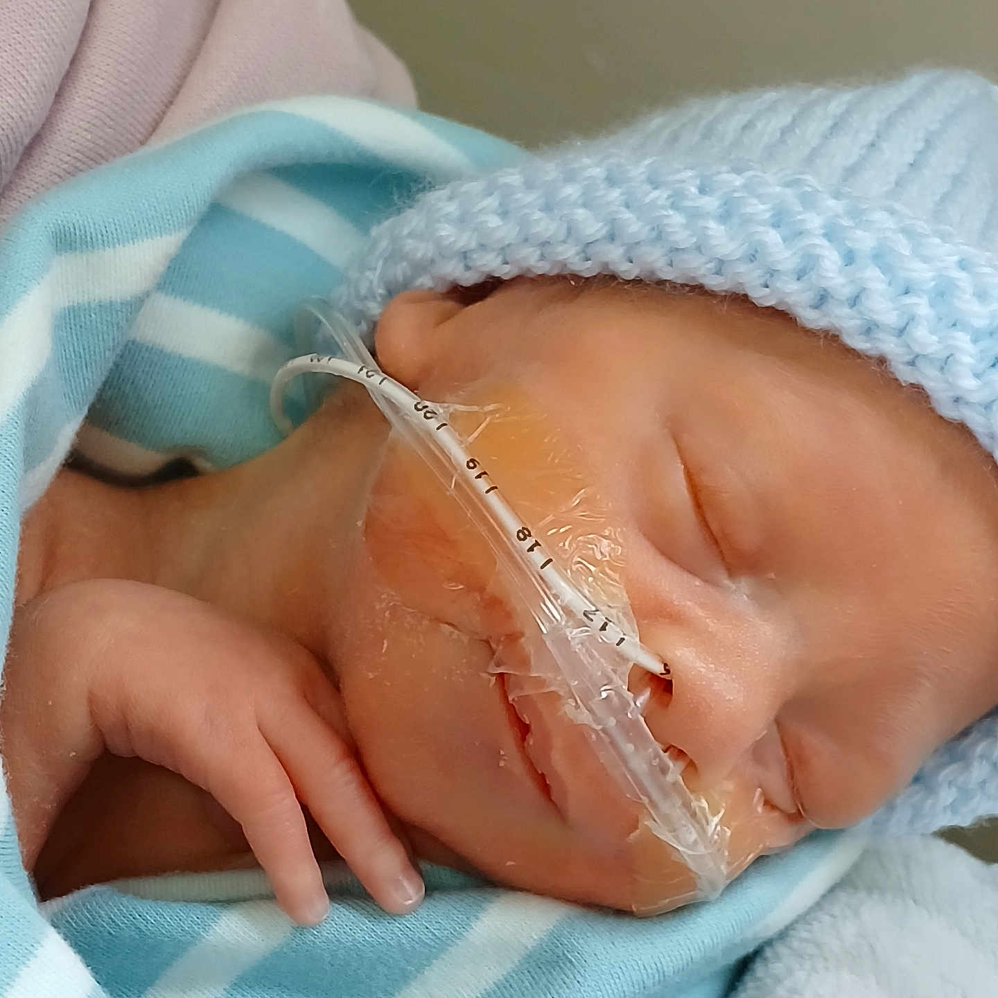 Max is registered to the contest to win money with this photo: architecture, baby, blade, bodypart, bonnet, building, cap, clothing, face, finger, hand, hat, head, hospital, newborn, person, photography, portrait, razor, weapon