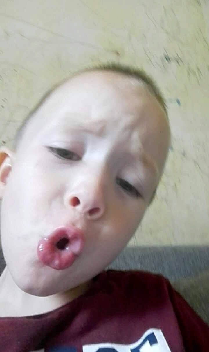 Alaric participe au concours pour gagner de l'argent avec cette photo : baby, cheek, chin, ear, eye, eyebrow, eyelash, face, finger, forehead, gesture, hair, head, iris, jaw, lip, mouth, neck, nose, person