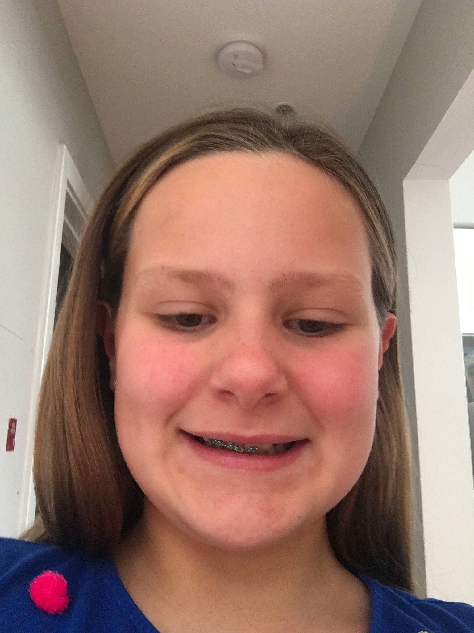 Abbey joined the competition — help win amazing prizes! cheek, chin, eye, eyebrow, face, facial_expression, forehead, hair, hairstyle, head, jaw, joy, lip, mouth, neck, nose, organ, person, selfie, skin