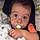 Albin
