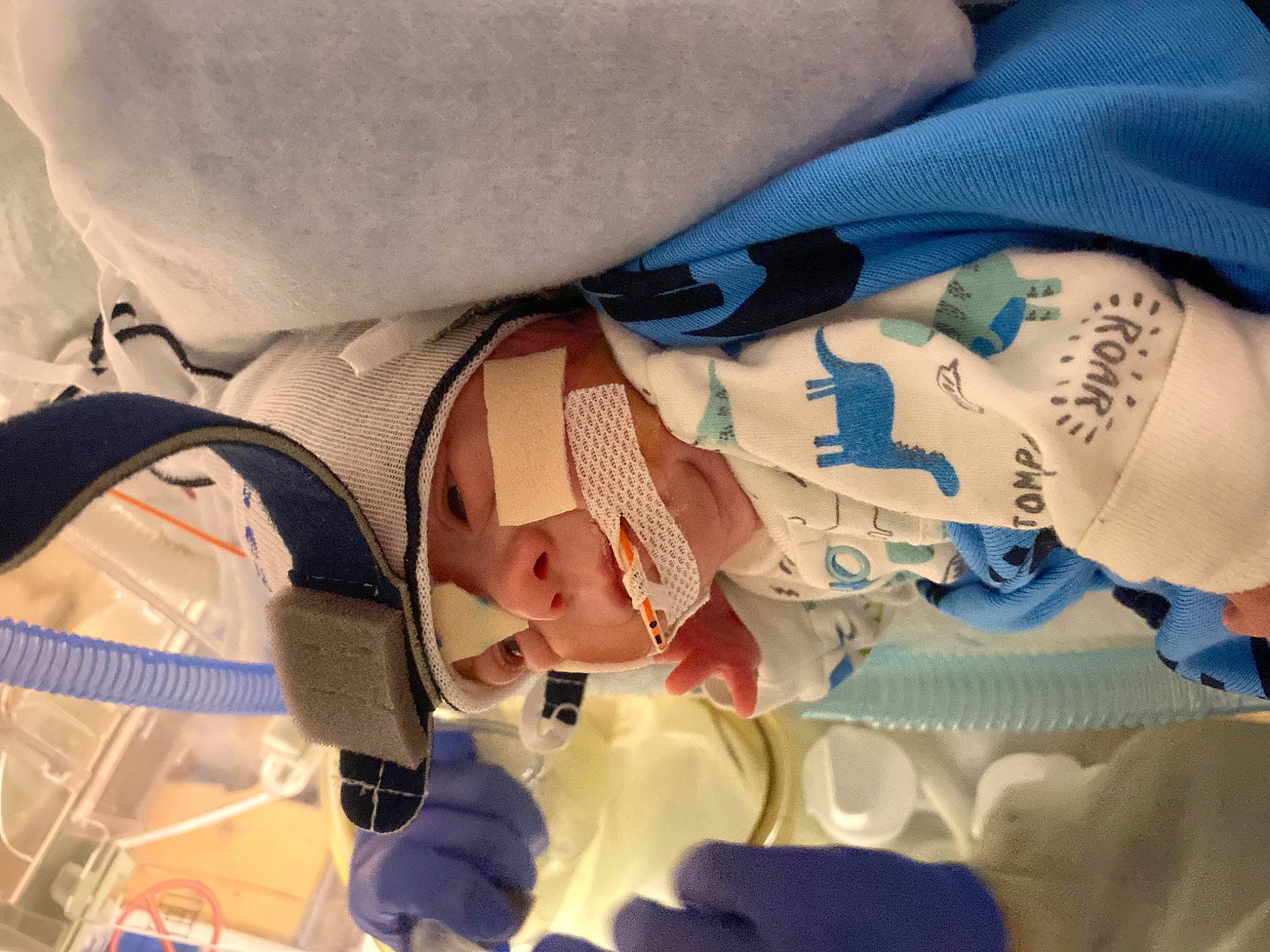 Asher joined the competition — help win amazing prizes! abdomen, arm, azure, baby, child, comfort, elbow, event, eyelash, gesture, headgear, human_body, human_leg, mouth, nail, skin, thigh, toddler, tree, wrist