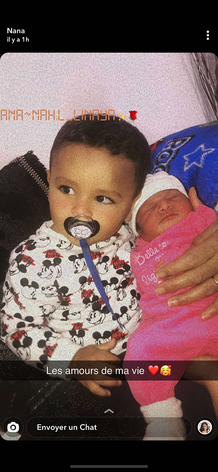 Linaya participe au concours pour gagner de l'argent avec cette photo : baby, cheek, child, forehead, head, mouth, neck, nose, person, photo_caption, toddler