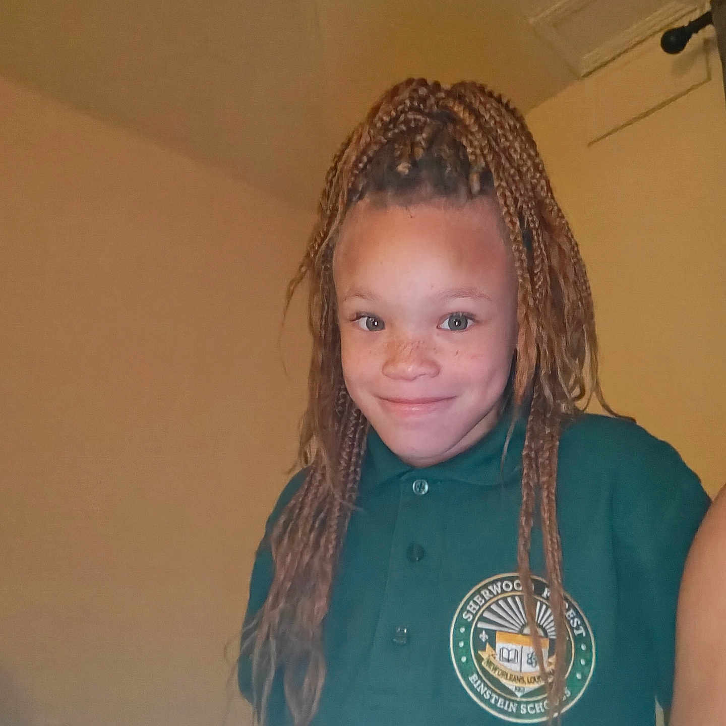 Bianca is registered to the contest to win money with this photo: baby, blonde, braid, child, cornrows, electricaldevice, face, female, girl, hair, head, microphone, person