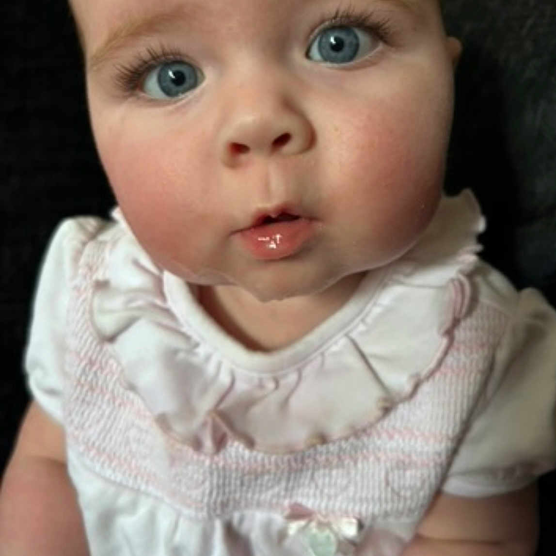Mollie is registered to the contest to win money with this photo: baby, blue_eyes, child, chubby_cheeks, closeup, curious, cute, expression, face, head, indoors, infant, mouth, person, portrait, ruffled_collar, sitting, skin, white_clothing, young_child