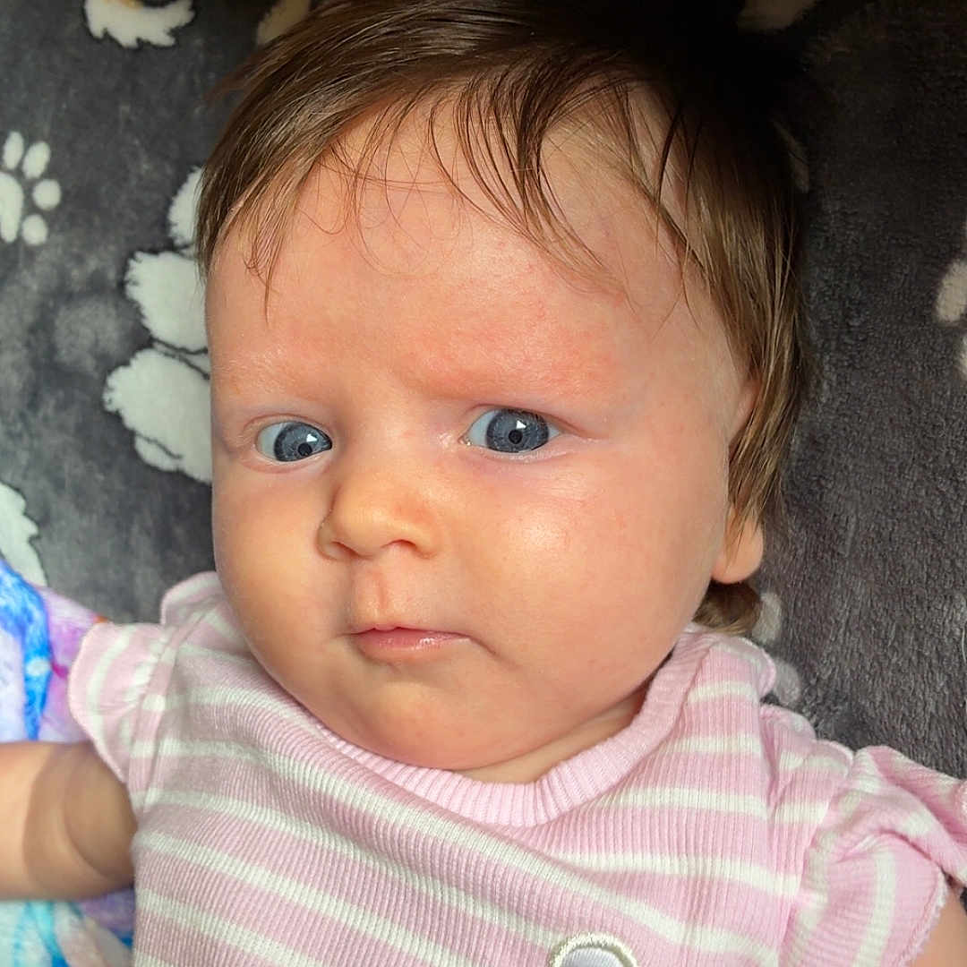 Liliana is registered to the contest to win money with this photo: baby, infant, child, blue_eyes, pink_clothing, striped_onesie, bear_patch, blanket, soft_texture, curious_expression, face, head, hair, skin, lying_down, indoors, portrait, closeup, cute, person