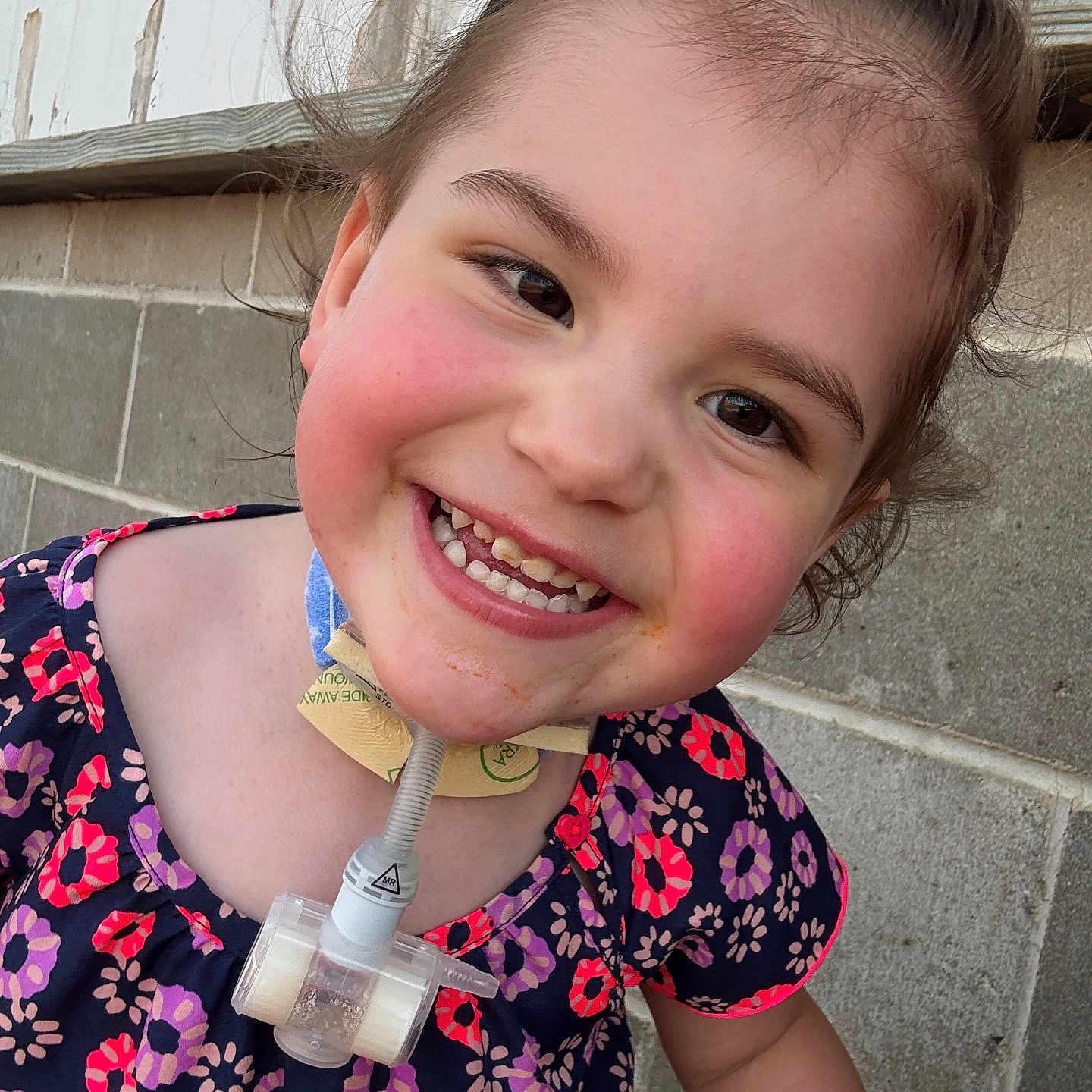 Maicee is registered to the contest to win money with this photo: brick_wall, brown_hair, casual, child, closeup, cute, daylight, dress, face, floral_pattern, happy, medical_device, neck, outdoor, person, portrait, rosy_cheeks, smiling, wooden_wall, young_child