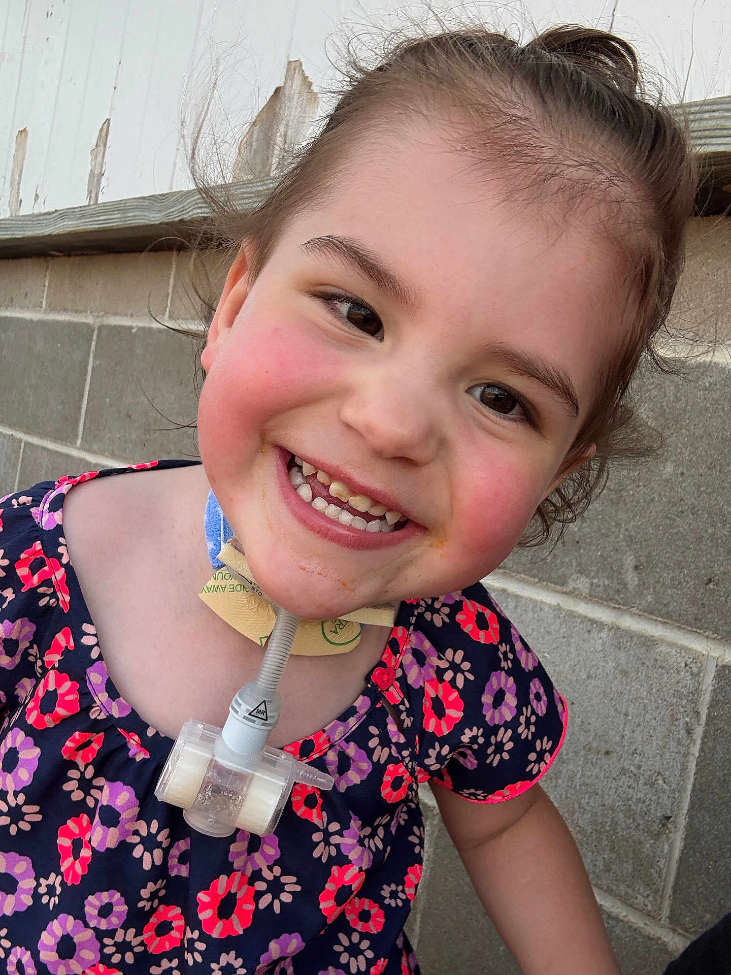 Maicee is registered to the contest to win money with this photo: child, smiling, face, dress, floral_pattern, rosy_cheeks, medical_device, neck, brown_hair, outdoor, brick_wall, wooden_wall, happy, person, closeup, young_child, cute, portrait, casual, daylight