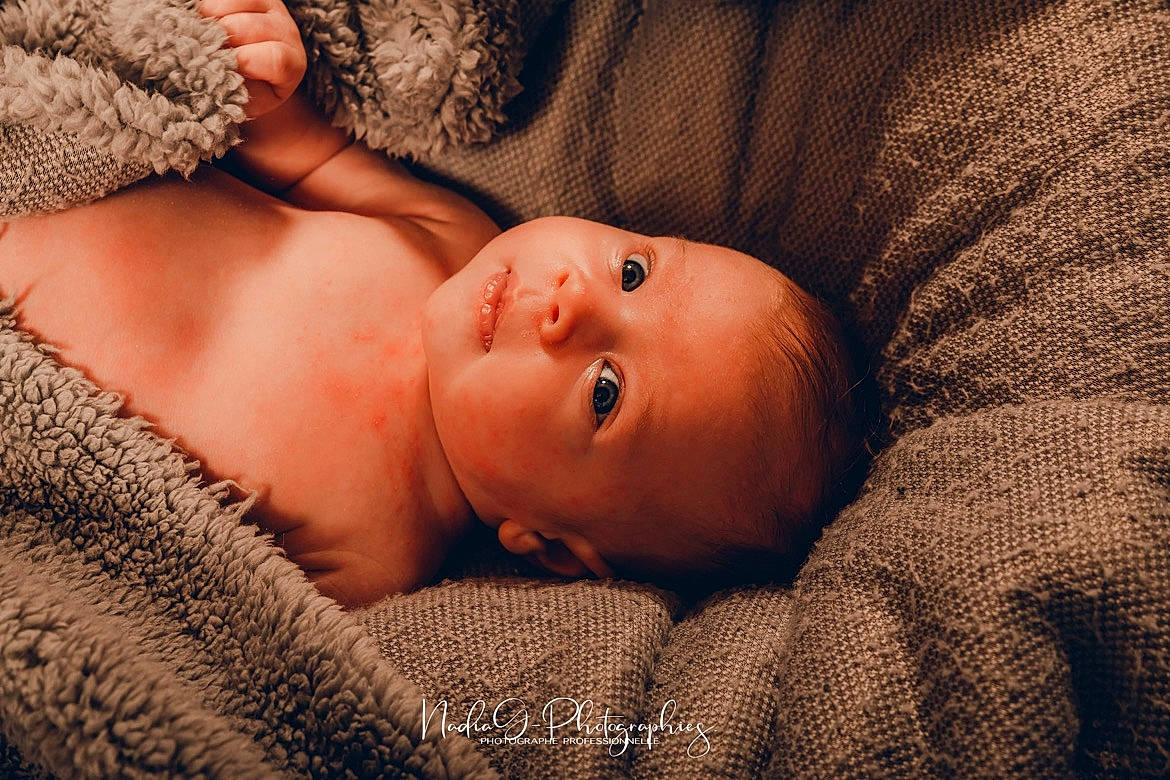 Judith participe au concours pour gagner de l'argent avec cette photo : abdomen, art, baby, cheek, chest, comfort, eye, eyelash, fawn, flash_photography, head, human_body, iris, lip, nose, person, skin, toddler, tree, trunk