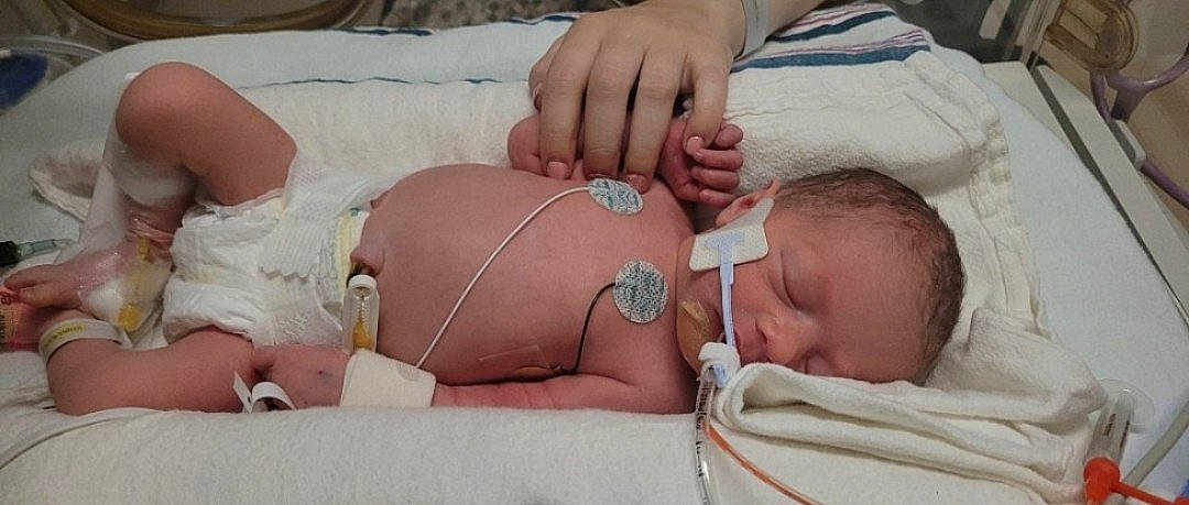 Sadie is registered to the contest to win money with this photo: abdomen, baby, chest, child, comfort, elbow, finger, gesture, hand, human_body, human_leg, joint, leg, pattern, person, service, skin, stomach, thigh, trunk