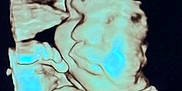 Trinity is registered to the contest to win money with this photo: ultrasound, fetus, pregnancy, 3d_ultrasound, baby, womb, prenatal, medical_imaging, face, hand, scan, healthcare, embryo, gestation, shadow, blur, black_background, human, profile, medical