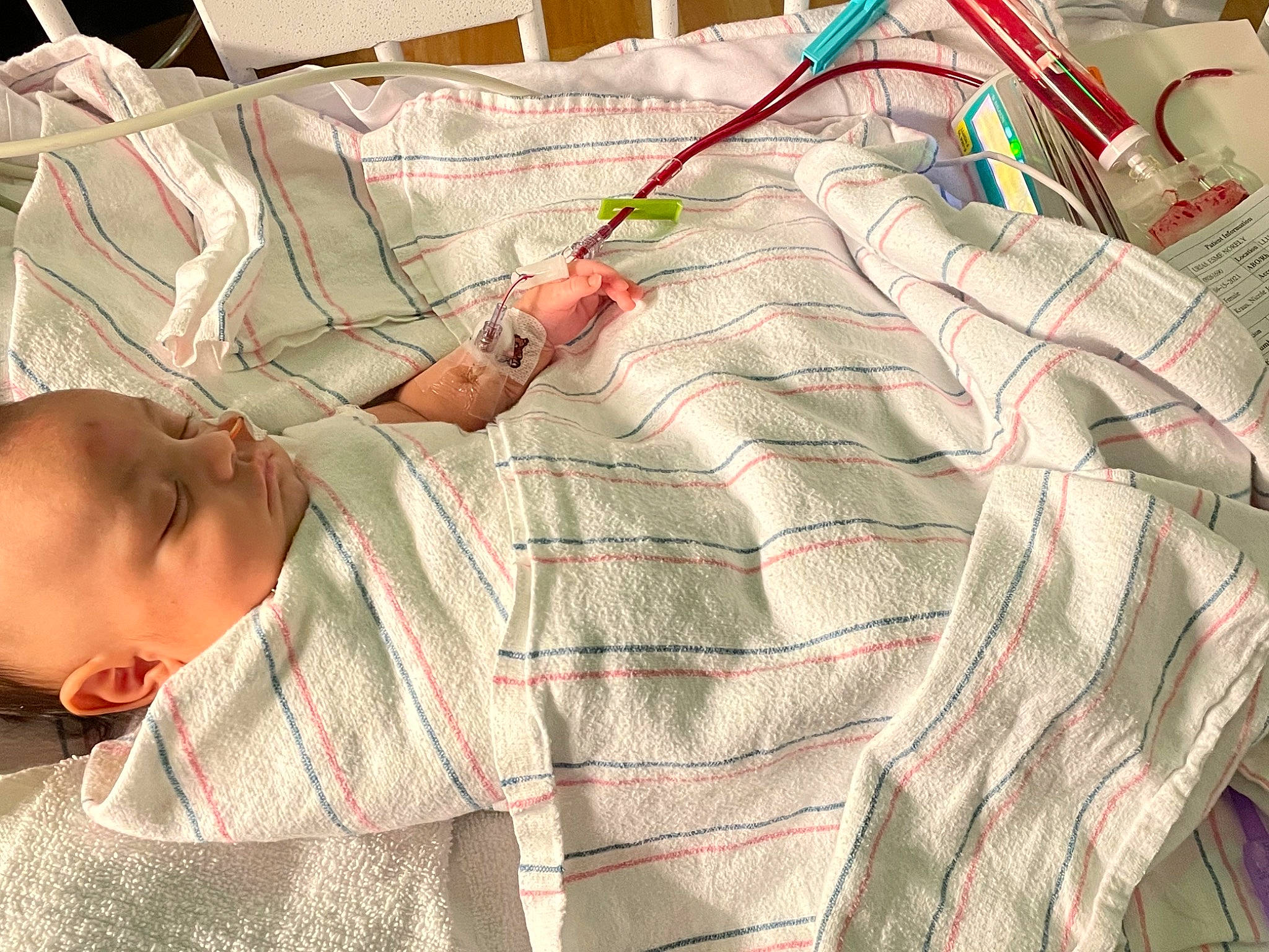 Esme is registered to the contest to win money with this photo: arm, art, baby, cable, electrical_wiring, glasses, hand, human_leg, linens, medical_procedure, military_camouflage, patient, pattern, person, room, service, t_shirt, textile, toddler, visual_arts