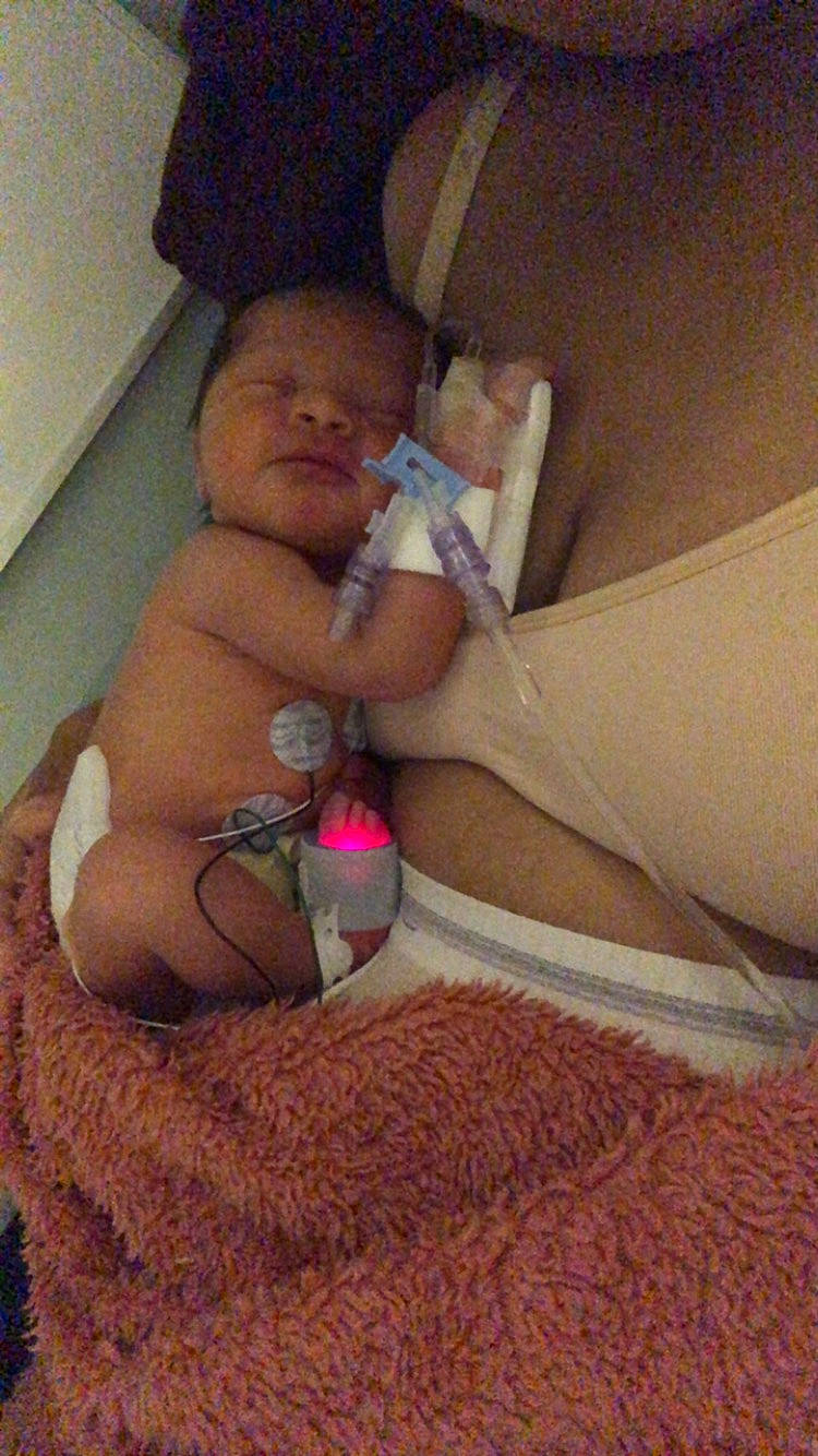 Xylah is registered to the contest to win money with this photo: abdomen, baby, baby_products, baby_sleeping, barechested, bedding, bedtime, chest, child, comfort, diaper, foot, human_leg, infant_bed, linens, person, room, thigh, thumb, toddler