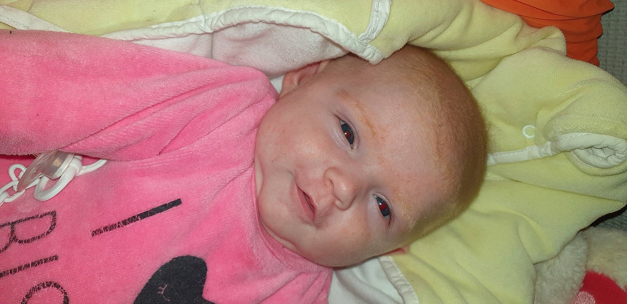 Milla a rejoint le concours — aidez-le/la à gagner de superbes lots ! arm, baby, baby_toddler_clothing, cheek, chin, comfort, ear, eye, eyebrow, facial_expression, hand, head, human_body, iris, lip, mouth, nose, person, pink, skin