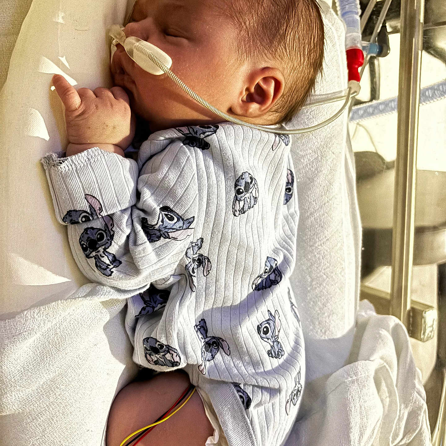 Orphéa participe au concours pour gagner de l'argent avec cette photo : baby, bed, blanket, cartoon_print, child, cozy, cute, healthcare, hospital, infant, medical_tubes, monitoring_wires, newborn, onesie, person, resting, side_view, sleeping, soft_lighting, toddler