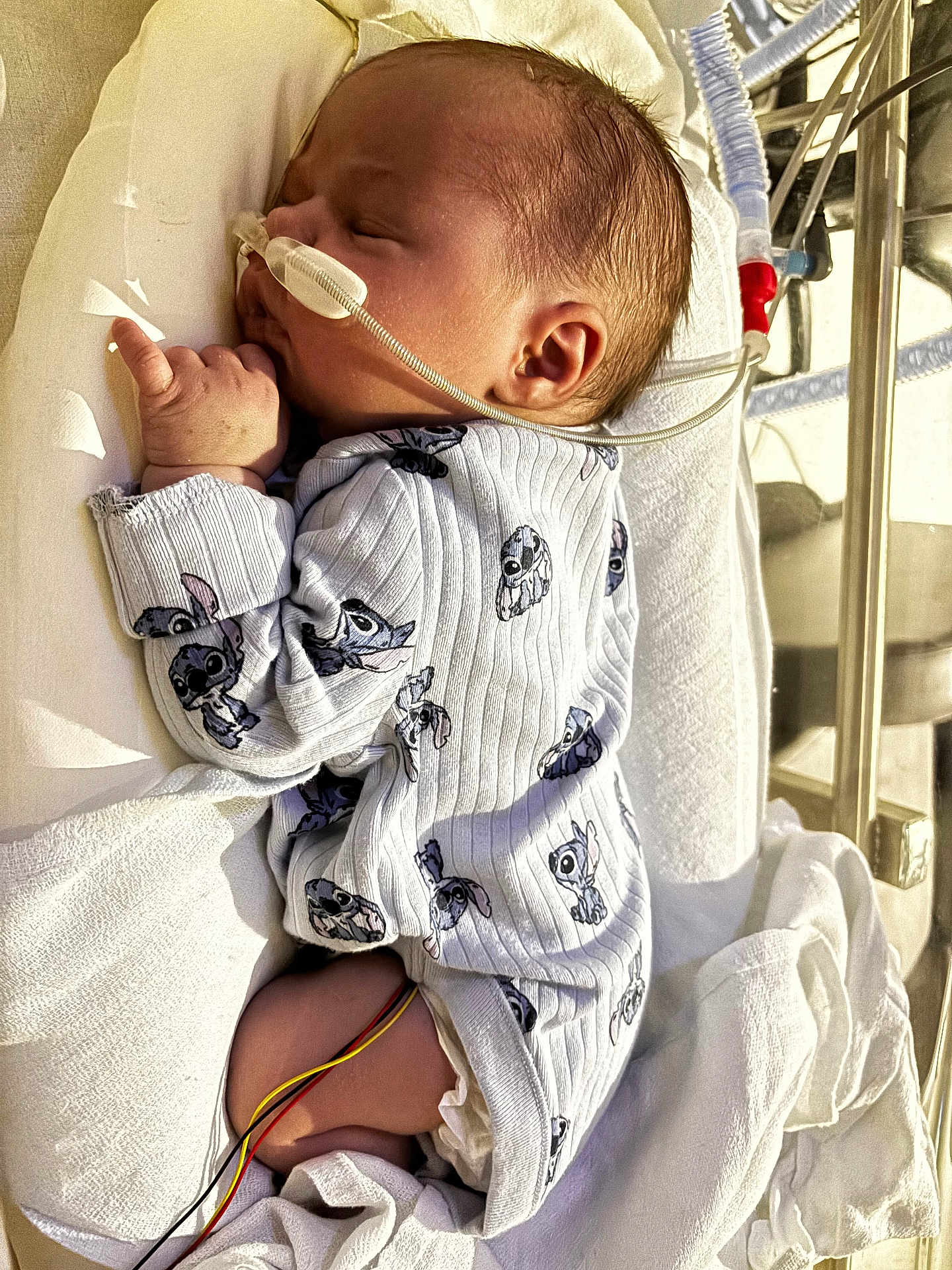 Orphéa participe au concours pour gagner de l'argent avec cette photo : baby, bed, blanket, cartoon_print, child, cozy, cute, healthcare, hospital, infant, medical_tubes, monitoring_wires, newborn, onesie, person, resting, side_view, sleeping, soft_lighting, toddler